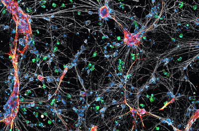 Tri-culture of neurons, microglia, and astrocytes Hoechst Iba1 GFAP Tuj1